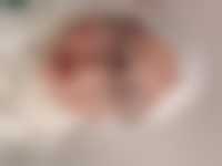 صورة العضو